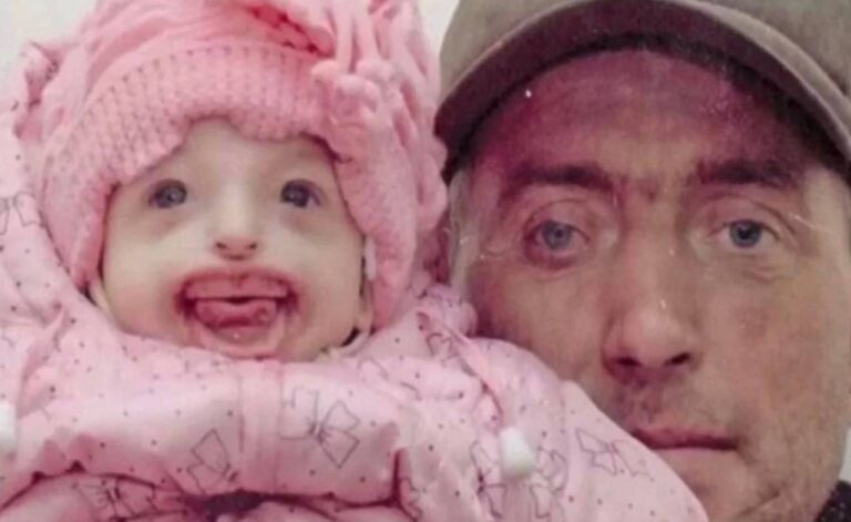 Când își vede fiica, mama leșină: cum poate o tânără născută fără buze să își construiască o viață plină de sens?