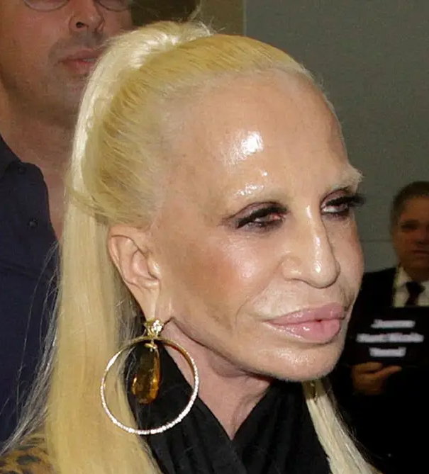 Înainte de operațiile estetice, Donatella Versace arăta complet diferit… și era de o frumusețe remarcabilă.