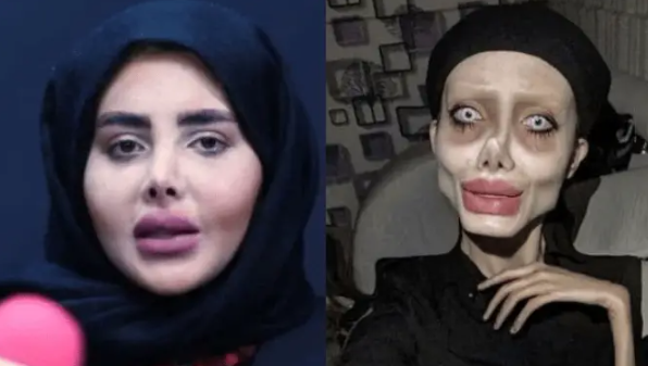 A trecut prin 50 de operații pentru a semăna cu Angelina Jolie. Descoperă cum arăta înainte.
