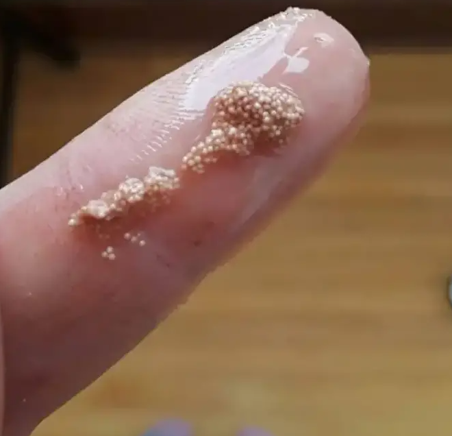 Am descoperit niște sfere bizare și lipicioase în ouă — inițial am crezut că sunt insecte, dar realitatea s-a dovedit a fi și mai înfiorătoare.